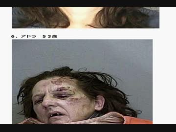 アル中　before and after