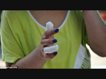 中国のATMがヤバイ、感電し女性の爪が吹き飛ぶ！