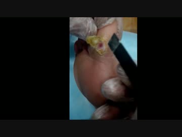 【修正版】魚の目の芯を穿り抜いてみた！その２