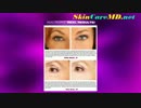 DermaGen Anti-Aging Cream - Your Solution For Best Anti-Aging Results.mp4