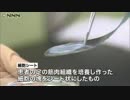 細胞シートを一般的治療に　条件付きで承認