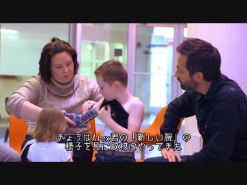 【字幕付き】3Dプリンタ製の義手【海外の反応】