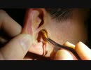 YouTubeのEarwax(耳垢)動画で最も再生されてるやつ