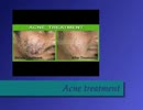 skin specialist hoshiarpur skin treatment in hoshiarpur