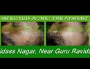 Skin specialist Bathinda Skin treatment in Bathinda .