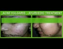 Skin specialist batala Skin treatment in Batala.