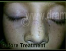 Skin specialist Phagwara Skin treatment in Phagwara.