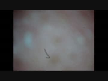 角栓出そうとしたらもうなんか色々出てきた