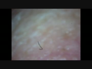 小鼻を指で押すとニュル
