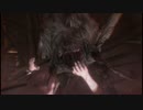 【実況】時間に追われるバイオハザードリベレーションズ2 Part10