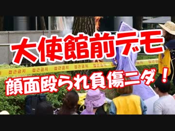 【大使館前デモ】 顔面殴られ負傷ニダ！