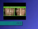 Natural skin treatment