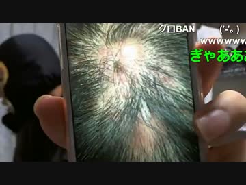 20160114 暗黒放送　病院に行って手術を拒否され今日から薬漬け放送 1/2