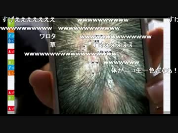 横山緑のハゲ越しにコメントを読むうんこちゃん