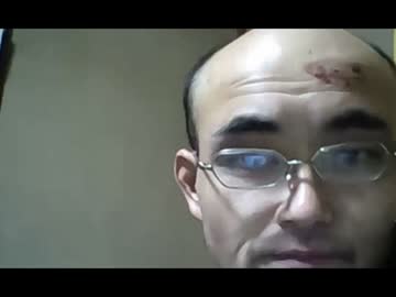 居眠り事故　前頭部に火傷