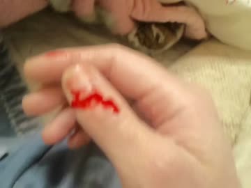 【流血注意】　メイ(=‘ｘ‘=)２日目にケンカ勃発！