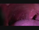 uvula in a slow-motion_スローのどちんこ