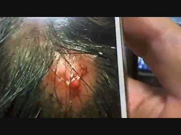 20160204 暗黒放送　2月病にかかった放送 1/2