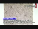 ｉＰＳから「がん攻撃」の免疫細胞　京都大