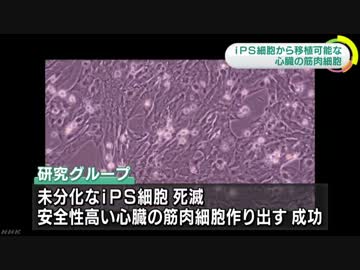 ｉＰＳ細胞から移植可能な心臓の筋肉細胞