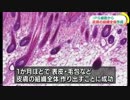 世界初 ｉＰＳ細胞から皮膚組織全体を再生