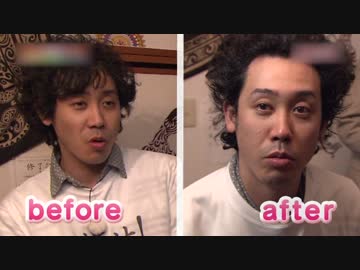 小顔矯正を受ける