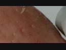 ピンセットで鼻の角栓を抜いてみた。続