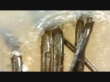 【500倍】角栓,頭皮,毛穴,血管を観察してみた【高画質】