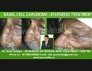 Super Speciality Ayurvedic Centre AYUR-SUDHA for Skin Diseases