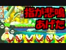 【実況】人差し指がつるマリオ【マリオメーカー】03