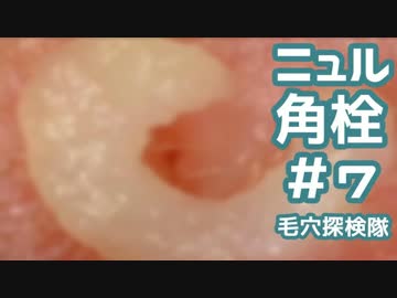 #7 幼虫？ニュルを高倍率で押し出してみた