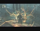 ［初見実況］ 敗者のブラッドボーン　Part8-1