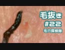 #22 毛穴視点で毛抜きを撮影してみた(毛根鞘&毛束もあるよ)