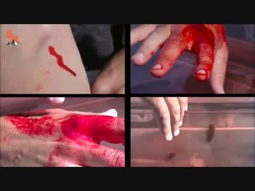 【観覧注意】いろんな虫に咬まれるおっさんが体張りすぎで凄い