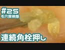 #23 角栓を連続で押し出してみた(150倍で大収穫