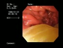 【丸呑み】胃で食べ物が消化される様子を観察してみた〜みかん〜【vore】