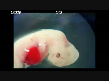 【ch】うんこちゃん『雑談』1/6【2017/03/10】