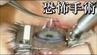 【衝撃】視力0.01の世界が危険すぎ！視力を回復する最新技術手術が怖すぎ
