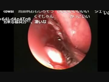 【ch】うんこちゃん『夜(雑談)』4/6【2017/04/11】