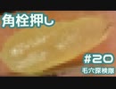 #20 角栓を200倍で押し出してみた