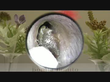 プロの耳掃除キャプチャー8