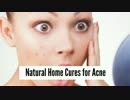 Get rid of acne fast Home remedies that gets rid of pimples immediately