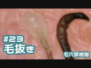 #23 毛根鞘大量！毛穴視点で毛抜きを撮影してみた