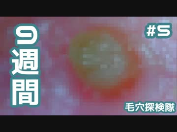 #5 角栓を9週間育ててみた(大物シリーズ)