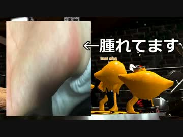 プロコンにゲンコツをしすぎて右手が痛いです。【スプラトゥーン2】