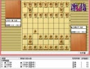 気になる棋譜を見よう１１９９（三浦九段　対　木村九段）