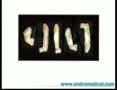 1.남근 증량제, 안드로 페니스, 음경 증가, 일어나라 남자 https://www.andromedical.net/ko/