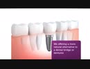 Apple Dental Group : Best Dental Implants in Miami