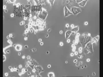 ガン細胞を白血球が攻撃する映像