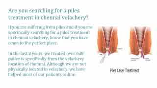 Piles treatment | Hemorrhoids treatment | Piles Managament